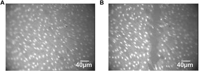 An automated method to discover true events and classification of intracellular Ca2+ profiles for endothelium in situ injury assay